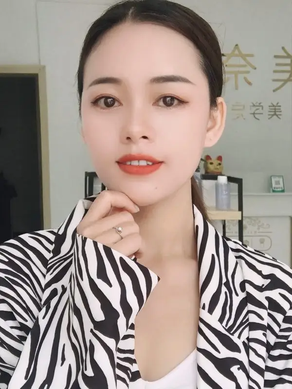 massage for migraine Beijing Xunyicao